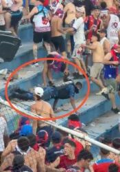 Policía quedó sin dientes y con la nariz rota