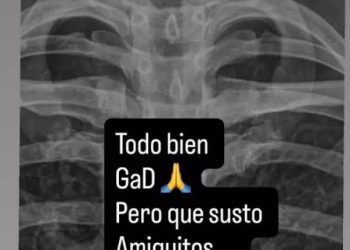 (VIDEO) ¡Dionoguarde! Cantante terminó en el hospital por una fuerte caída haciendo pilates
