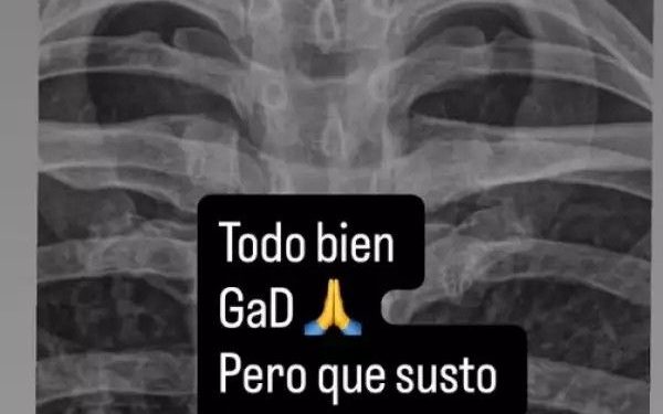 (VIDEO) ¡Dionoguarde! Cantante terminó en el hospital por una fuerte caída haciendo pilates