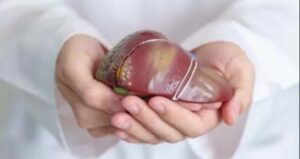 Salud presentó guía pyahu para hepatitis B